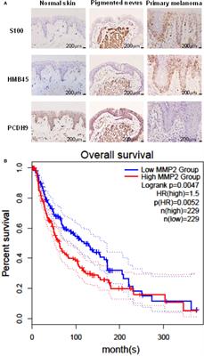PCDH9 suppresses melanoma proliferation and cell migration
